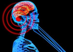 Do mobile phones cause brain tumours?